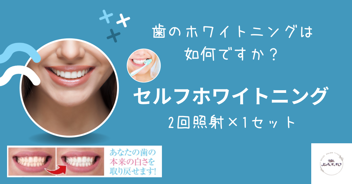 セルフホワイトニング