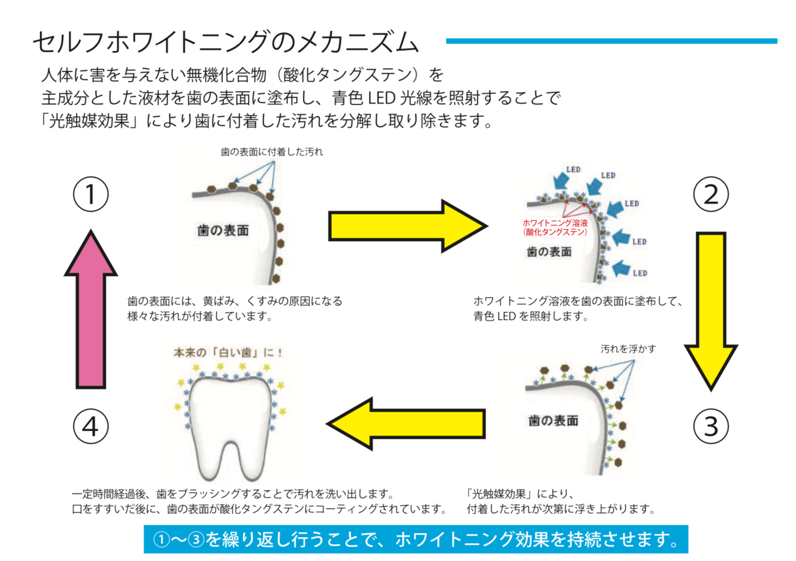 ホワイトニング