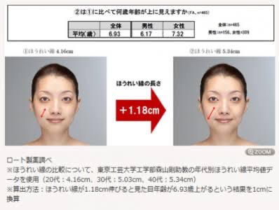 ほうれい線